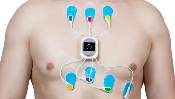 ELETTROCARDIOGRAMMA DINAMICO SECONDO HOLTER napoli