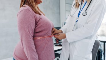 Trattamento Obesità napoli
